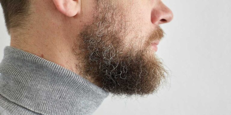 barbe clairsemée