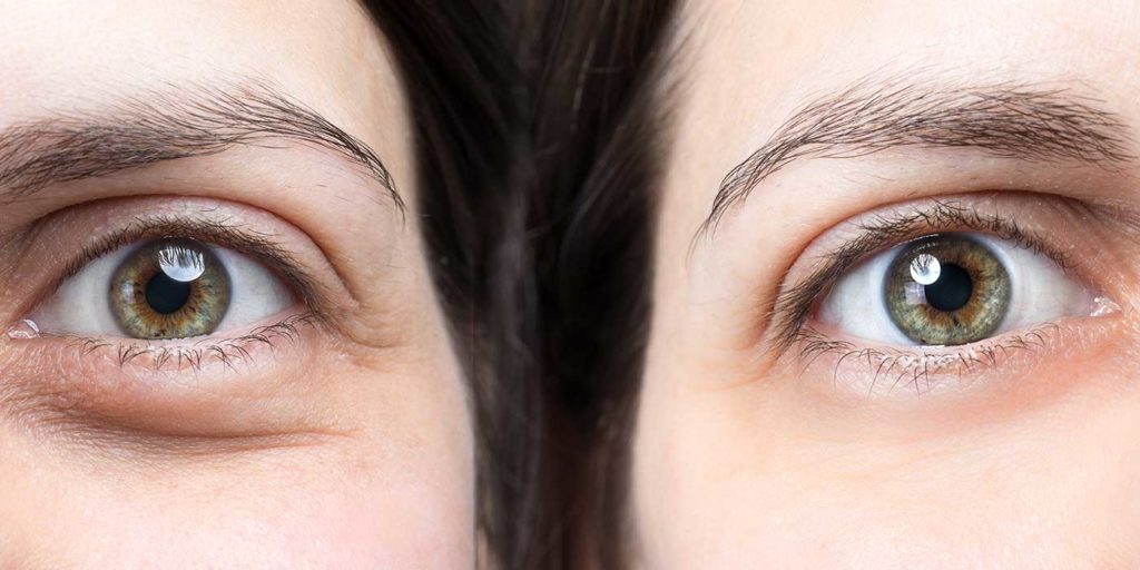 Anticernes pour homme, les solutions vraiment efficaces